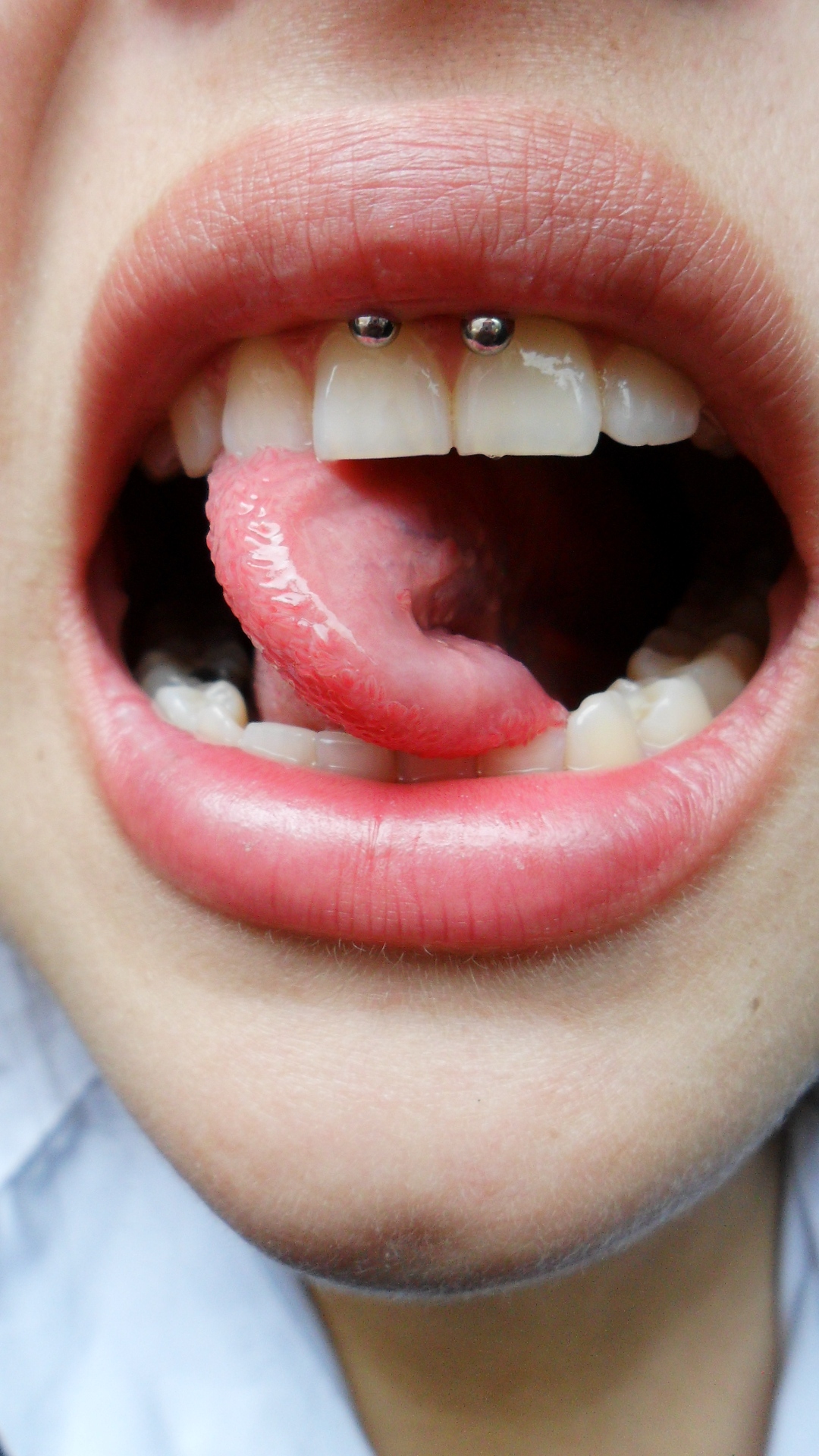 Bimbo Double Tongue Piercing
